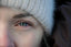 Close-up of dry winter skin around the eye showing seasonal tightness and dehydration